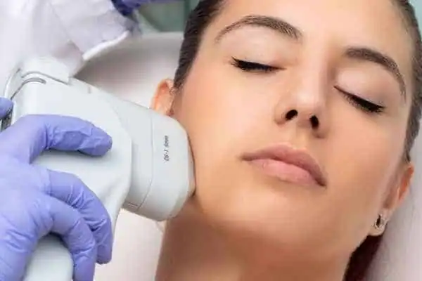 Image of woman having HIFU Yorkshire treatment