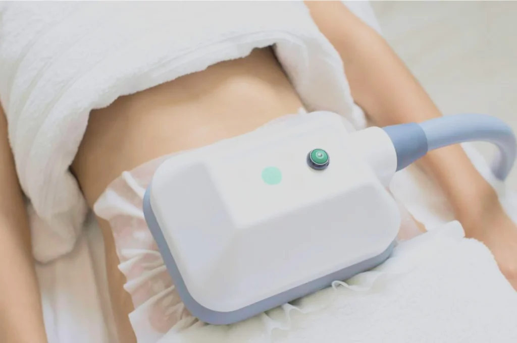 How Fat Freezing and HIFU Work Together? 3 advantages to combining Fat Freezing and HIFU Yorkshire