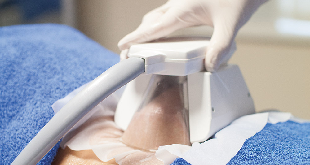 How Fat Freezing and HIFU Work Together? 2 Multiple Areas in One Session HIFU and Fat Freezing Yorkshire