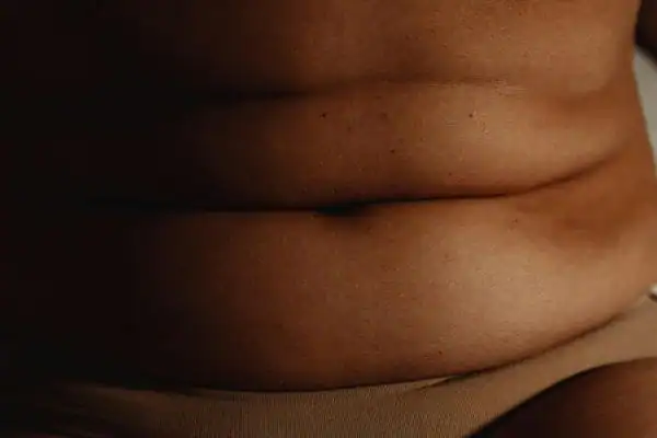 The Hidden Connection: How Stress Shapes Your Fitness and Body Composition 3 image of what stress can do on the stomach area and how Lipo 360 Yorkshire can help to change your body shape.
